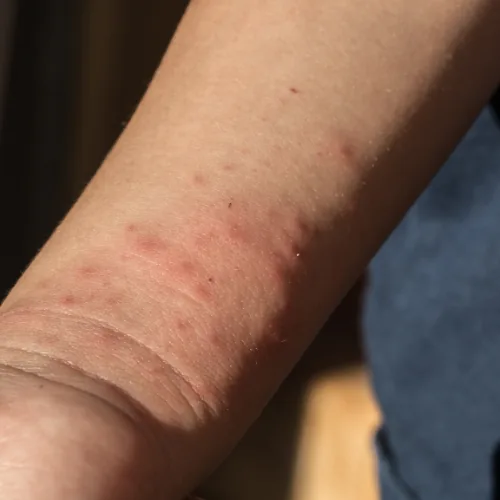 Punaise de lit cachée dans un matelas